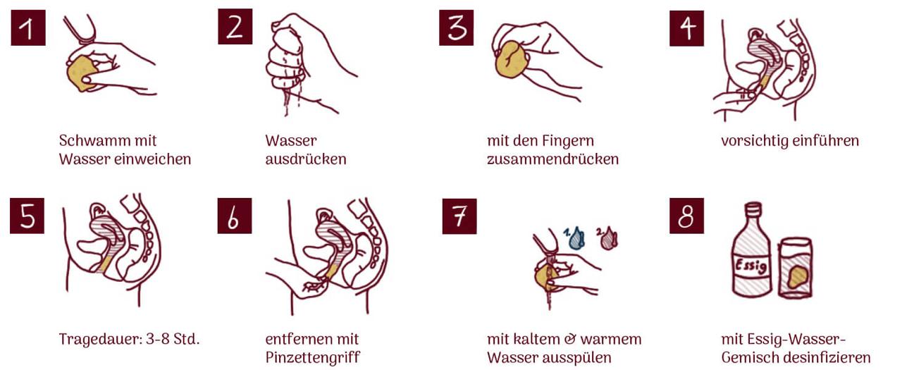 Anleitung zur Verwendung eines Menstruationsschwamms in acht Schritten, von Einweichen und Einführen bis zum Entfernen und Reinigen mit Essig-Wasser-Gemisch.